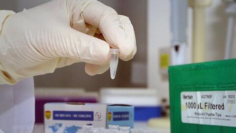 Việt Nam thúc đẩy các phương án nghiên cứu, sản xuất vaccine COVID-19