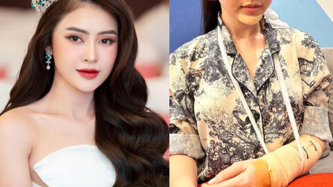 Hoa hậu Lý Kim Thảo bị tai nạn giao thông, phải rời khỏi Miss Universe Vietnam 2023