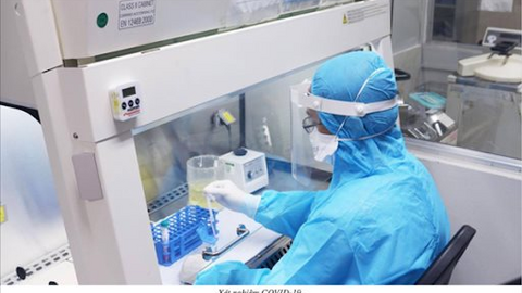 TP.HCM: 45.000 mẫu xét nghiệm tại các bệnh viện âm tính với COVID-19