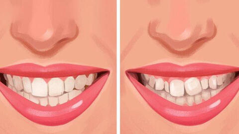 Điều gì sẽ xảy ra nếu thở bằng miệng khi ngủ?