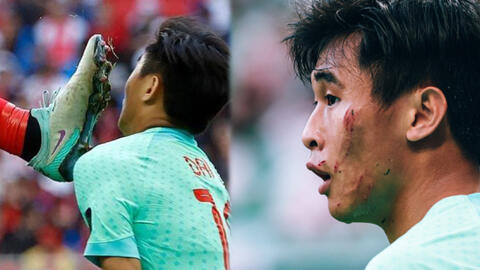 Asian Cup 2023: Cầu thủ Trung Quốc bị đối thủ đạp trúng mặt, quyết định sau đó của trọng tài gây tranh cãi