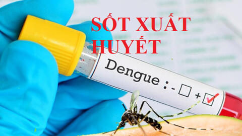 Tổ chức Y tế Thế giới khuyến cáo biện pháp phòng bệnh sốt xuất huyết