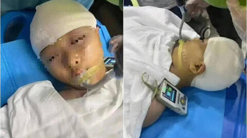 Vụ nữ sinh bị "tác động vật lý" đến mức vỡ hộp sọ: Quá khứ của thầy giáo bị vạch trần
