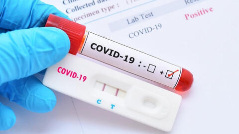 Bộ Y tế chính thức lên tiếng về việc bộ kit test nhanh COVID-19 có giá chênh lệch