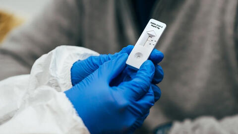 Tại sao vạch test nhanh Covid-19 có lúc mờ lúc nhạt?