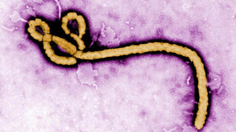 Nghiên cứu mới: Virus Ebola có thể “ẩn náu” trong cơ thể chờ ngày "kích hoạt"