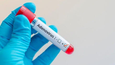 Khi nào cần xét nghiệm Adenovirus?