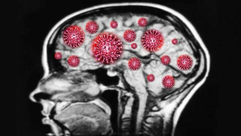 Nghiên cứu mới: Virus Covid-19 có thể xâm nhập vào não