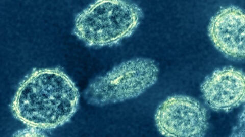 Chuyên gia cảnh báo virus H1N1 ở Trung Quốc có thể gây ra đại dịch