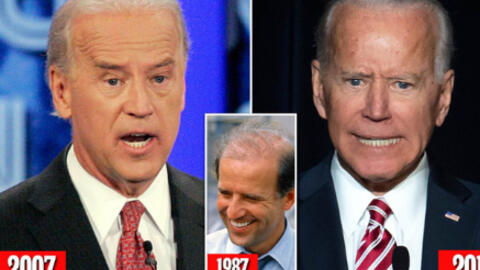Bằng chứng cho thấy Ông Joe Biden phẫu thuật thẩm mỹ để "níu kéo tuổi xuân"