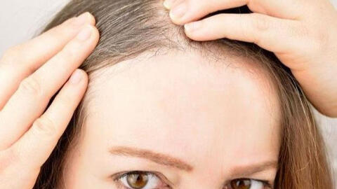 Tại sao nhiều người trẻ lại có tóc bạc sớm?