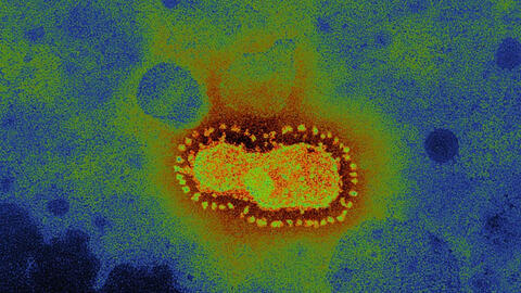 Coronavirus - 'Nỗi sợ của những điều chưa biết' và những tia sáng hi vọng
