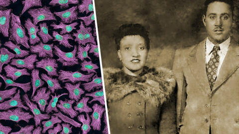 Henrietta Lacks: Người phụ nữ da màu tạo đột phá trong cuộc chiến chống ung thư cổ tử cung