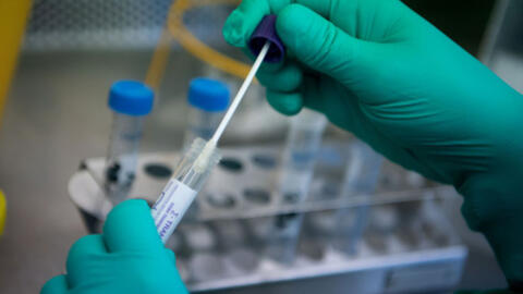 Dịch vụ xét nghiệm PCR quá tải