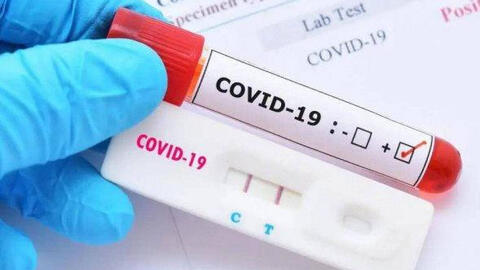 TP.HCM, Kiên Giang kiểm tra đột xuất việc mua bán kit test COVID-19