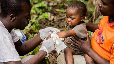 Peru là quốc gia Nam Mỹ thứ hai giải mã thành công trình tự gene virus đậu mùa khỉ.