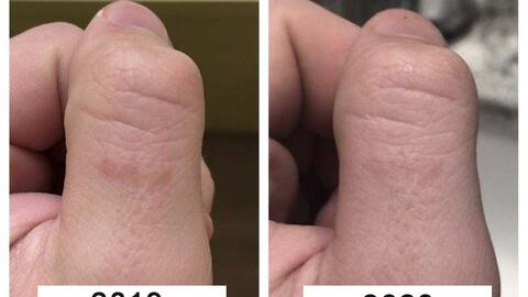 6 tác dụng của vitamin C giúp làm đẹp da không ngờ