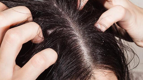 Ngứa da dầu, người đàn ông qua đời sau 3 tháng: 4 cơn ngứa cảnh báo bệnh nặng hoặc ung thư