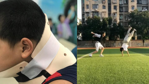 Bé trai 10 tuổi bị vẹo cổ vì học theo trò nhào lộn trên Tik Tok
