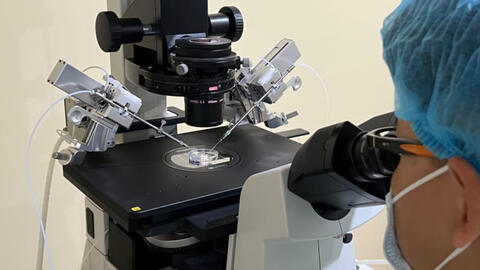 Thụ thai thành công cho hai cặp vợ chồng không có tinh trùng