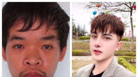 Báo Malaysia 'bái phục' chàng trai Việt chi ra 400 triệu đồng để phẫu thuật...vì bị chê xấu khi đi xin việc