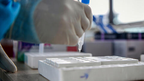 Test nhanh Covid-19 tại nhà cần lưu ý những gì?