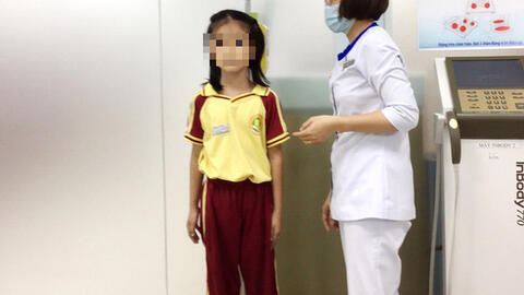 Ở Việt Nam, cứ 4 trẻ dưới 5 tuổi thì có một trẻ bị suy dinh dưỡng thấp còi