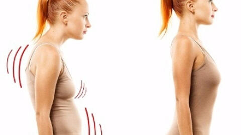 Bài tập ngăn ngừa gù lưng, cải thiện tư thế