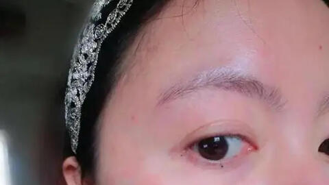 6 dấu hiệu trên khuôn mặt tiết lộ sức khỏe của bạn