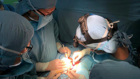 Mổ tách thành công cặp song sinh dính nhau ở gan