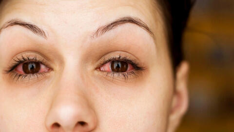 Nhiều bệnh nhân Covid-19 xuất hiện triệu chứng đặc biệt