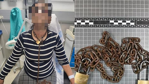 Người phụ nữ hốt hoảng đến bệnh viện cầu cứu với sợi xích trên cổ, biết nguyên nhân cảnh sát lập tức vào cuộc điều tra