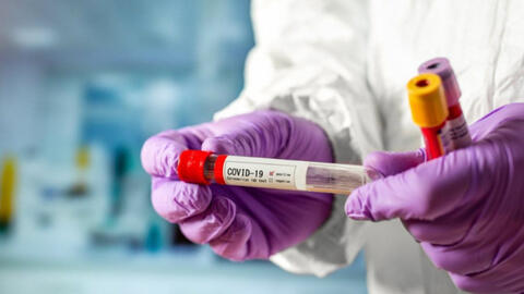 Nếu chưa có vắc xin hoặc thuốc chống Covid-19, chúng ta liệu có cần kế hoạch B?