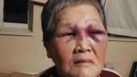 1 triệu USD ủng hộ cho cụ bà gốc Á bị tấn công tại Mỹ vì phân biệt chủng tộc