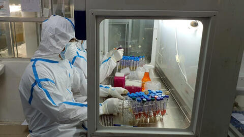 Đơn vị sản xuất vaccine Covid-19 nói gì về biến chủng virus SARS-CoV-2?