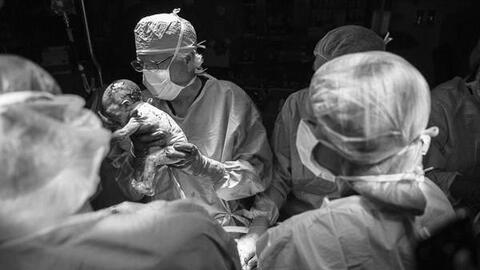 Bé gái đầu tiên ở Italy chào đời từ người mẹ được cấy ghép tử cung