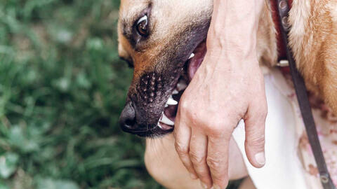 Hãi hùng trẻ bị chó cưng cắn