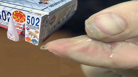 Mẹo tẩy keo 502 dính vào da đơn giản và an toàn