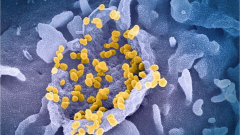 Biến chủng nCoV mới có thể kháng vaccine Covid-19