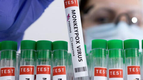 Bộ Y tế hướng dẫn các biện pháp phòng, chống tạm thời với bệnh đậu mùa khỉ