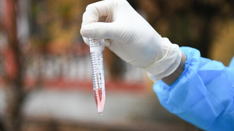 512 mẫu xét nghiệm ở Quảng Ninh âm tính với Covid-19