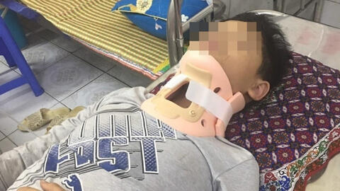 Học sinh lớp 4 bị hai bạn lớn đánh ngất xỉu trên đường đi học