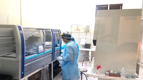 152 trường hợp F1 liên quan bệnh nhân người Nhật Bản đều cho kết quả âm tính với COVID-19