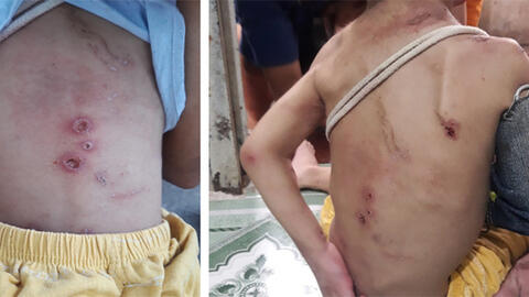 Vụ bé trai ở TP.HCM bị thương tích khắp người: Người mẹ thừa nhận đánh con