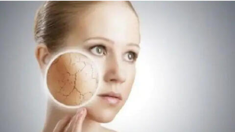 6 mẹo chăm sóc da giúp làn da luôn “ngậm nước” trong mùa đông