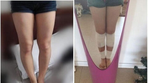 Có thể mất mạng vì kéo chân "sửa lỗi tạo hóa"