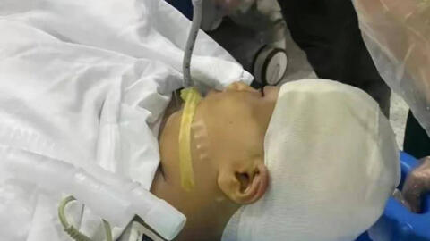 Nữ sinh lớp 4 bị thầy giáo dùng thước "tác động vật lý" đến mức vỡ hộp sọ, thái độ của "hung thủ" sau đó càng gây phẫn nộ hơn