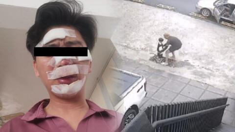 Con trai bị bắt cóc đòi tiền chuộc 1,5 tỷ VNĐ, bố bị thương khắp mặt vì liều mạng giành lại con và câu chuyện khó hiểu phía sau