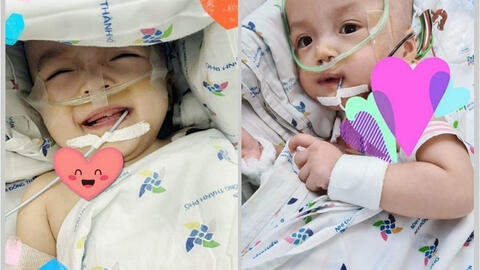 Hai bé Trúc Nhi, Diệu Nhi khỏe mạnh, ăn sữa tốt, bàn chân và ngón chân cử động thoải mái