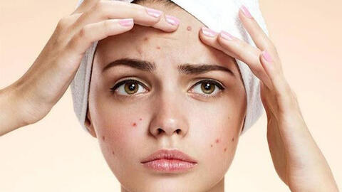 7 lầm tưởng về mụn trứng cá khiến mụn nổi ngày càng nhiều